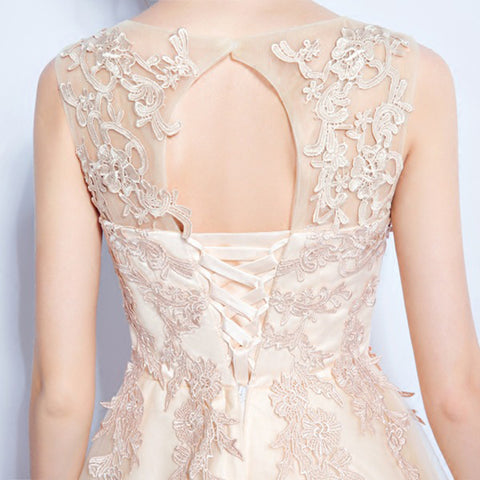 Image of Double Layered Lace Midi Dress - Itopfox